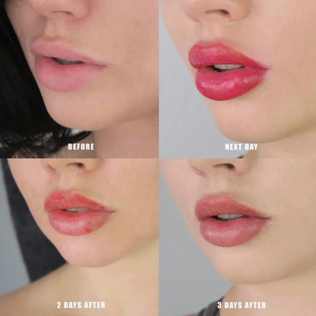 Lip Plumping Tips – How to Plump Your Lips Naturally